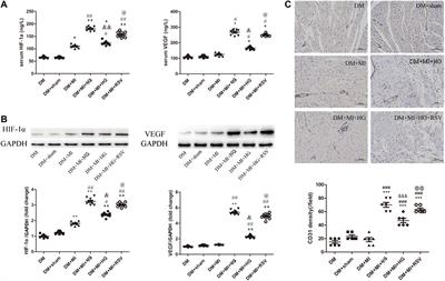 Resveratrol Pretreatment Improved Heart Recovery Ability of Hyperglycemic Bone Marrow Stem Cells Transplantation in Diabetic Myocardial Infarction by Down-Regulating MicroRNA-34a